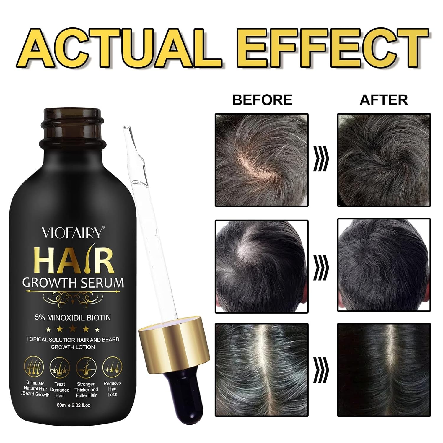 Minoxidil Hair Growth and Treatment Oil